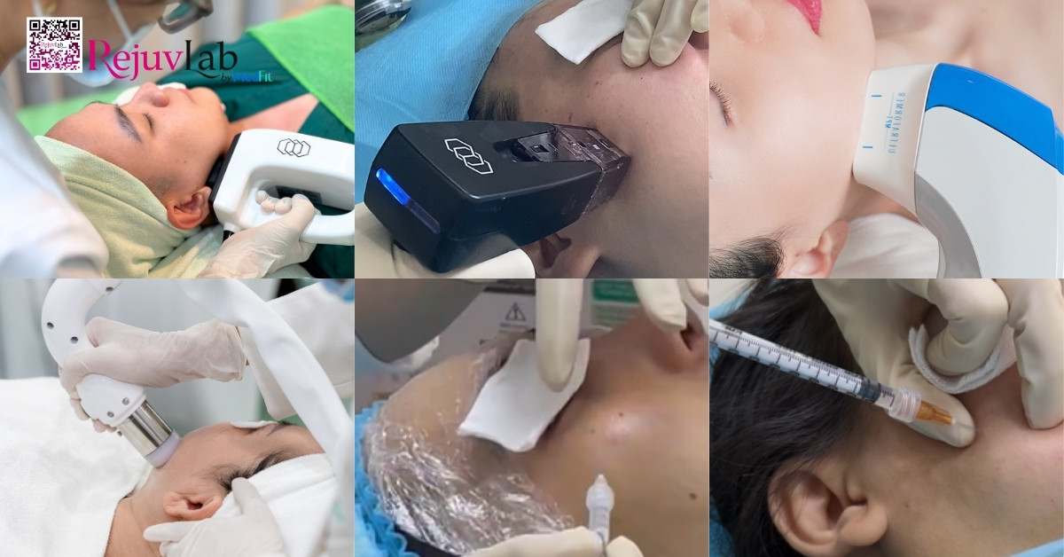 Phuong phap thon gon mat tai RejuvLab 1