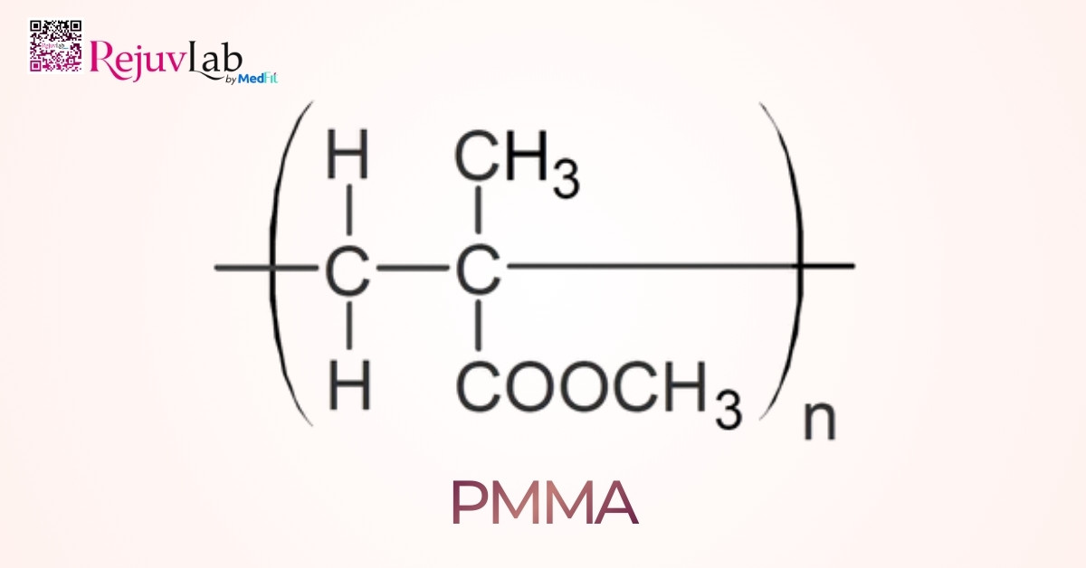 Tiêm filler bao lâu thì tan và khi nào nên tiêm lại? 3 Polymethylmethacrylate PMMA