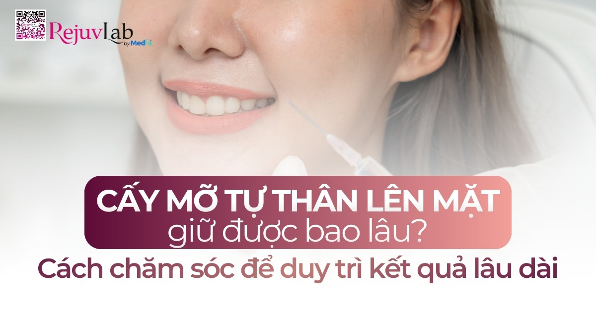 Thumb cấy mỡ tự thân lên mặt