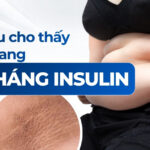 Dấu hiệu cho thấy cơ thể đang đề kháng insulin