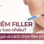 Giá tiêm filler hiện nay bao nhiêu? Bảng giá 2026 và cách chọn filler phù hợp