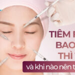 Tiêm filler bao lâu thì tan và khi nào nên tiêm lại?