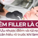 Tiêm filler là gì? Ưu nhược điểm và rủi ro cần hiểu rõ trước khi làm