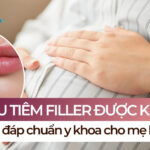 Có bầu tiêm filler được không? Giải đáp chuẩn y khoa cho mẹ bầu
