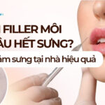 Tiêm filler môi bao lâu hết sưng? Cách giảm sưng tại nhà hiệu quả