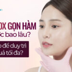 Tiêm botox gọn hàm giữ được bao lâu và làm sao để duy trì hiệu quả tối đa?