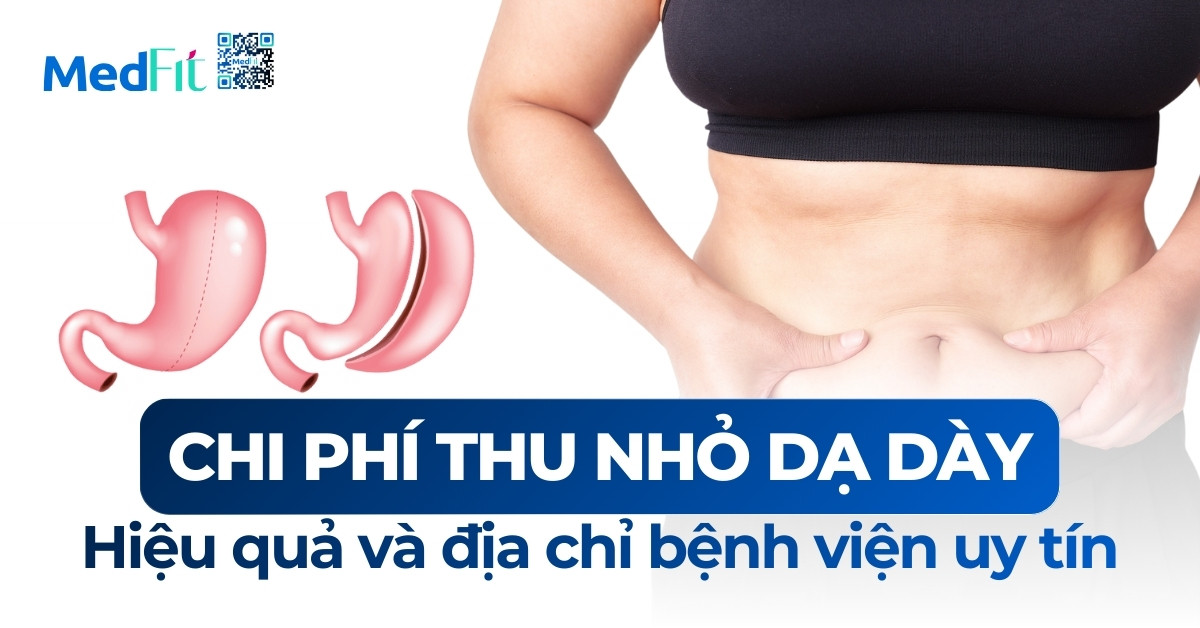 Thumb Chi phi thu nho da day