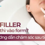 Tiêm filler bao lâu thì vào form? Hướng dẫn cách chăm sóc sau tiêm
