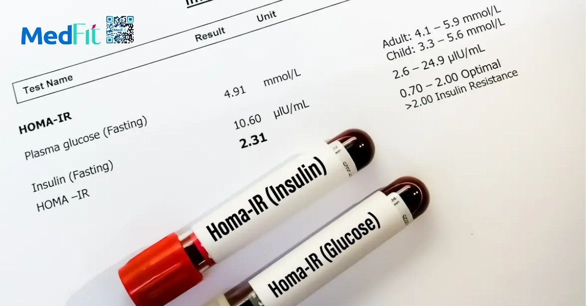 Dấu hiệu cho thấy cơ thể đang đề kháng insulin 10 Xet nghiem them