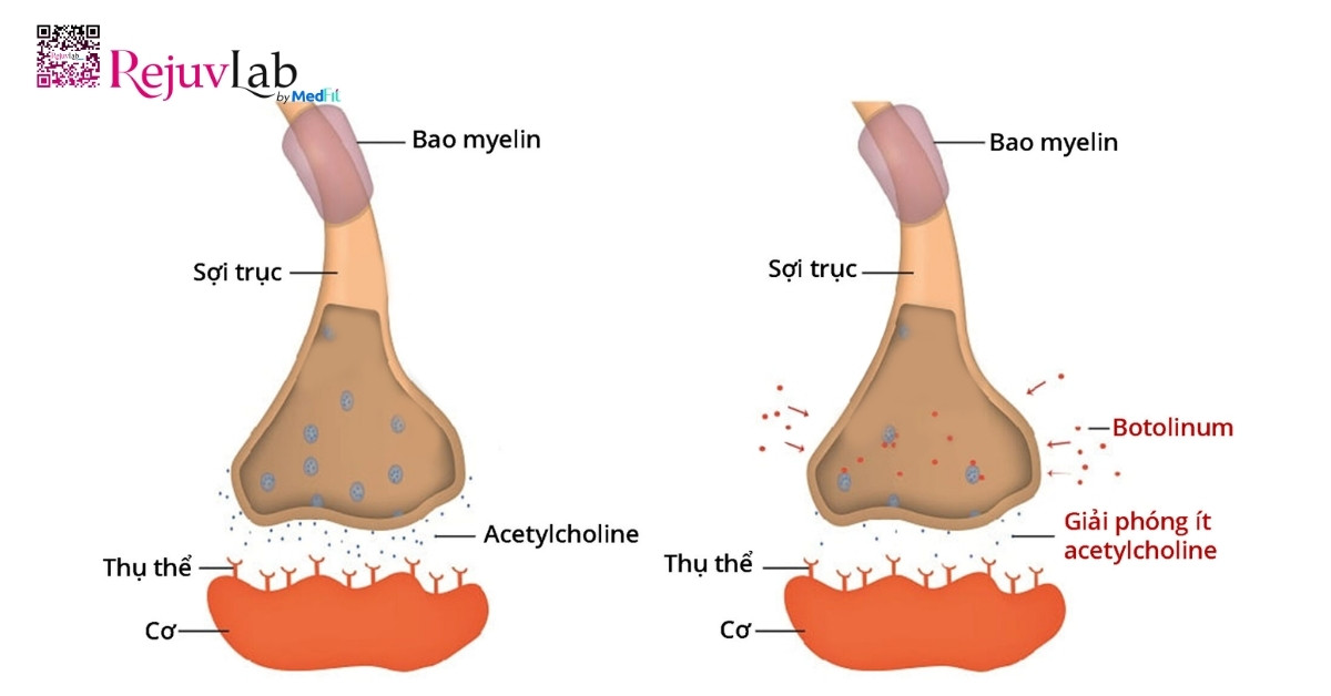 Tình trạng kháng botox là gì và cách phòng ngừa? 1 Co che tac dong cua botulinum