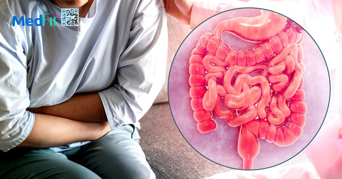 Vì sao mỡ nội tạng cao gây cản trở tiêu hóa? 4 Vì sao mỡ nội tạng cao gây cản trở tiêu hóa? 3