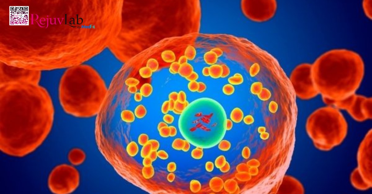 Tình trạng kháng botox là gì và cách phòng ngừa? 9 Kieu khang nguyen bach cau nguoi HLA