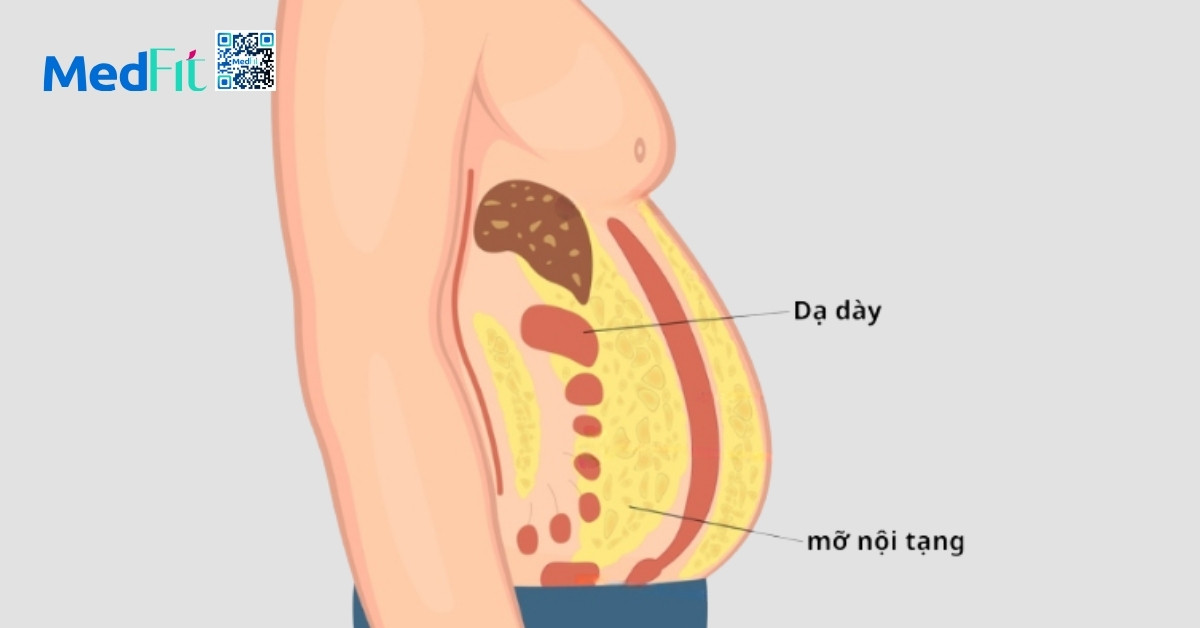 Vì sao mỡ nội tạng cao gây cản trở tiêu hóa? 8 Vì sao mỡ nội tạng cao gây cản trở tiêu hóa? 7