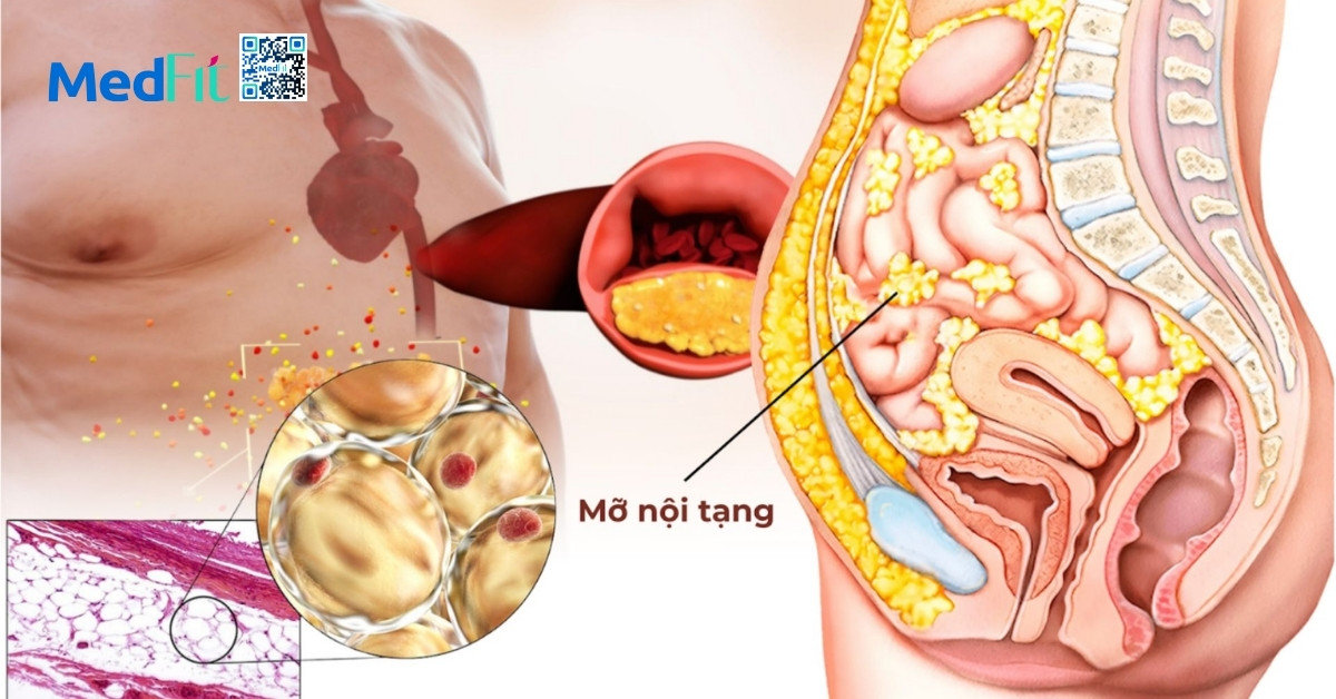Vì sao mỡ nội tạng cao gây cản trở tiêu hóa? 2 Vì sao mỡ nội tạng cao gây cản trở tiêu hóa? 1