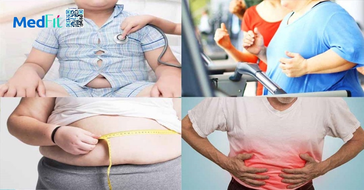 Suy thận và béo phì: Những cảnh báo không thể bỏ qua 7 Nhom beo phi
