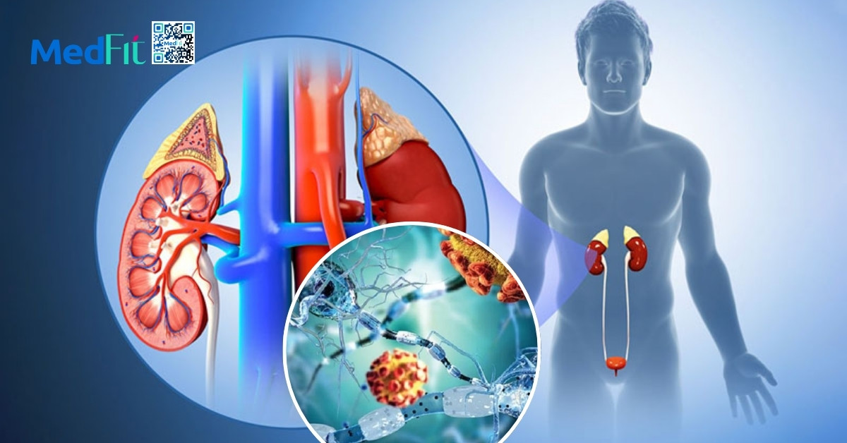 Suy thận và béo phì: Những cảnh báo không thể bỏ qua 4 Suy giam chuc nang mien dich