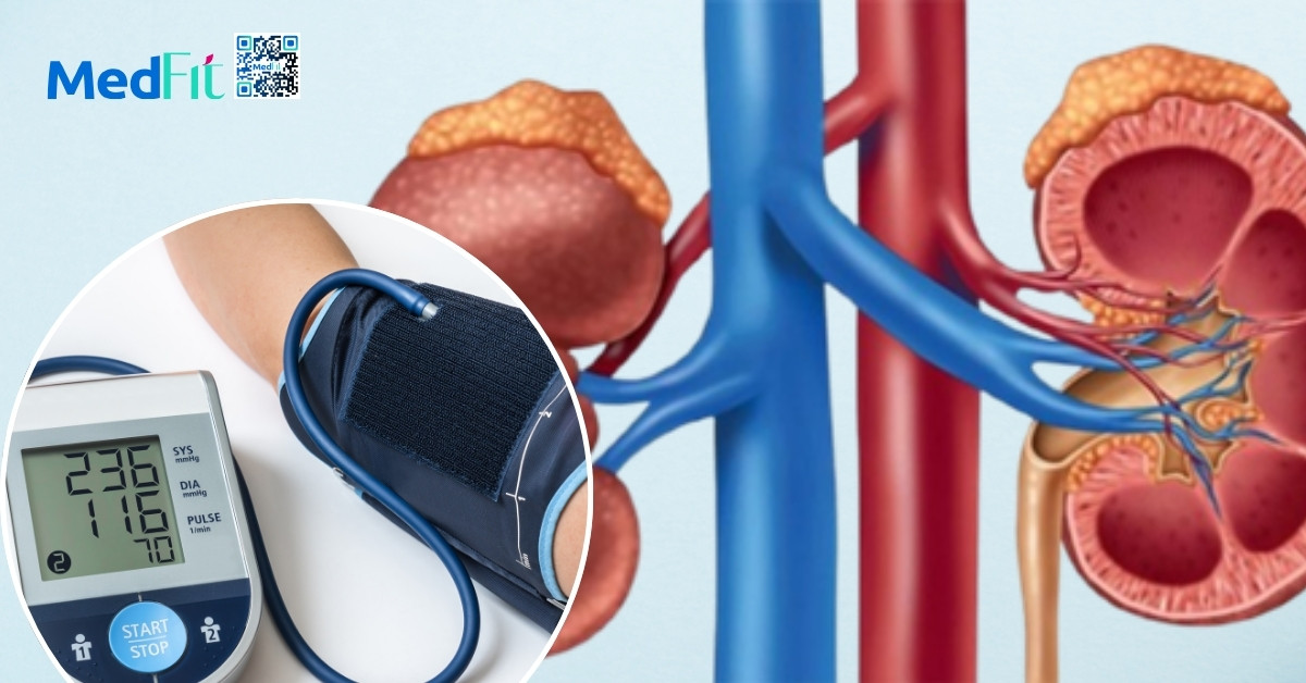 Suy thận và béo phì: Những cảnh báo không thể bỏ qua 3 Tang huyet ap