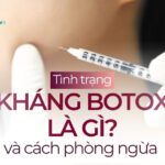 Tình trạng kháng botox là gì và cách phòng ngừa?