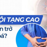 Vì sao mỡ nội tạng cao gây cản trở tiêu hóa?