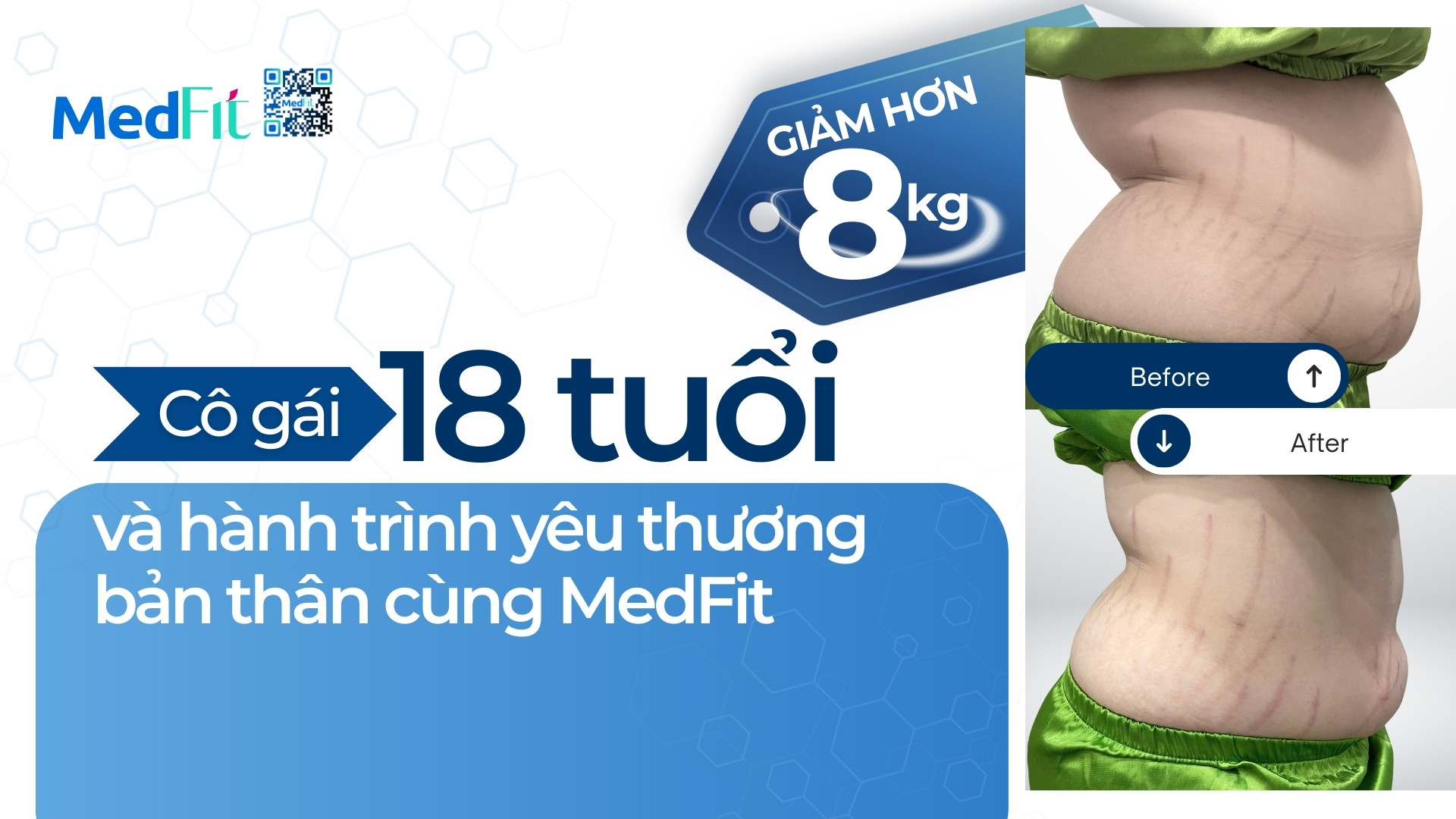 Thumb clip khách P.T