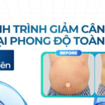 Hành trình giảm cân và lấy lại phong độ toàn diện ở tuổi trung niên của khách hàng A.H