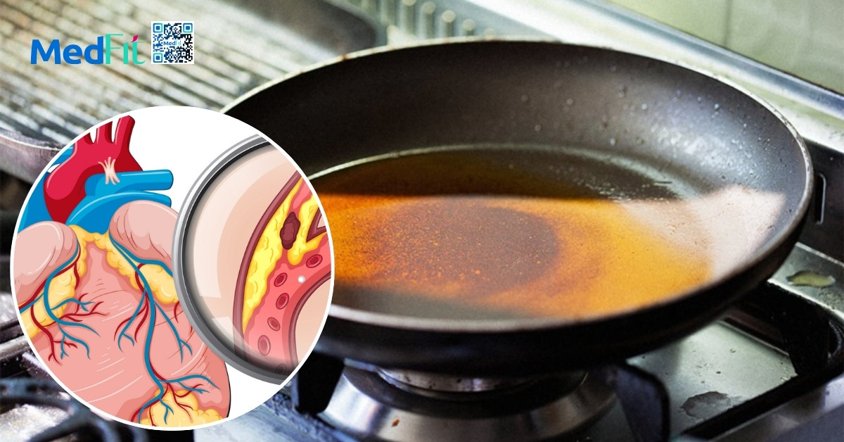 Dầu tinh luyện có đáng sợ không? Sự thật khoa học phía sau những lo ngại sức khỏe 14 Dầu tinh luyện có đáng sợ không? Sự thật khoa học phía sau những lo ngại sức khỏe 13