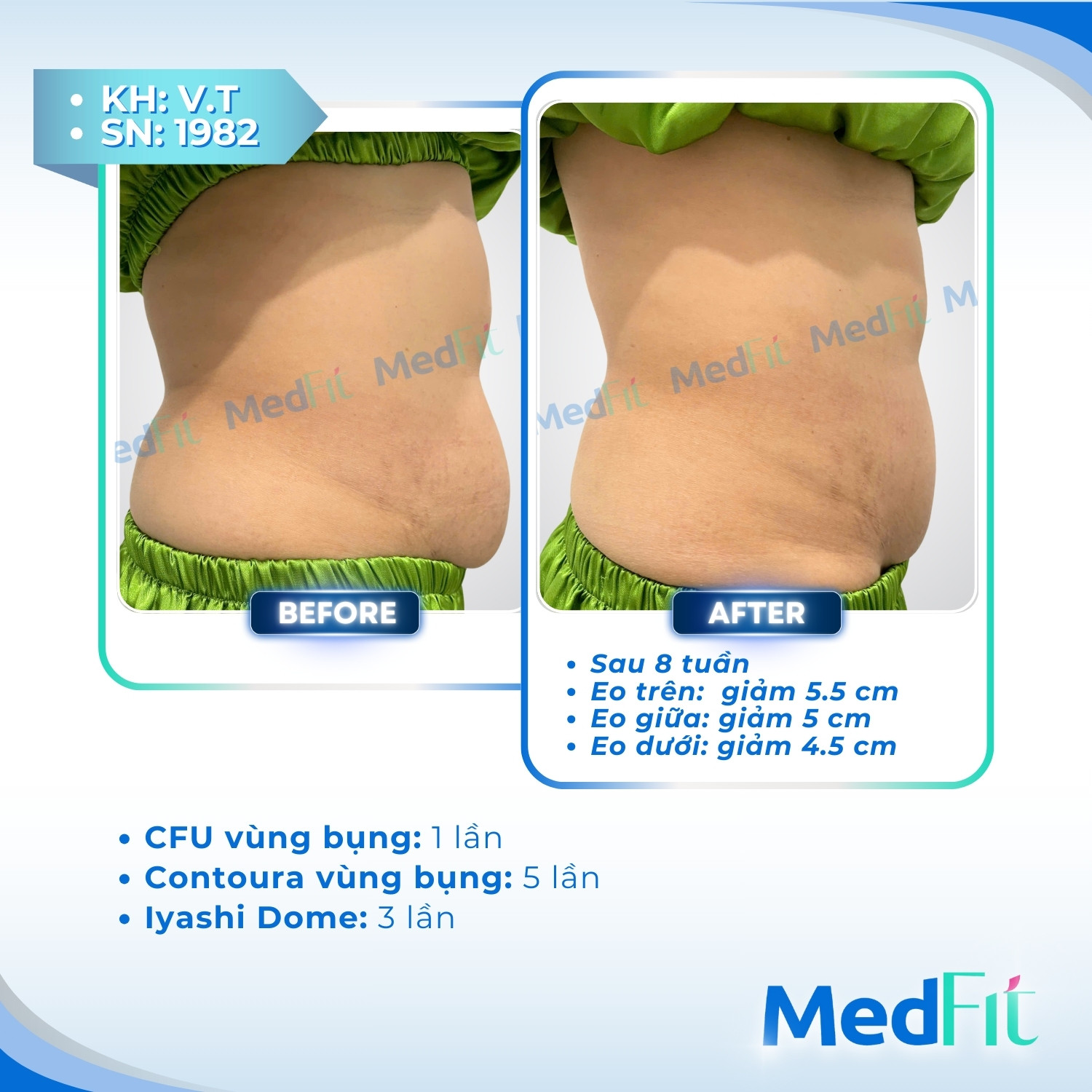 Bí quyết kết hợp vận động với các máy công nghệ cao để tối ưu hiệu quả tăng cơ giảm mỡ 19 Bí quyết kết hợp vận động với các máy công nghệ cao để tối ưu hiệu quả tăng cơ giảm mỡ 18