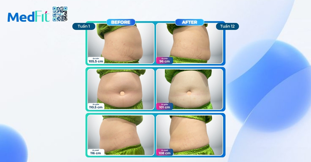 Hành trình giảm 7,5kg và 27cm vòng eo, tự tin tỏa sáng trong ngày trọng đại 7 Hành trình giảm 7,5kg và 27cm vòng eo, tự tin tỏa sáng trong ngày trọng đại 6