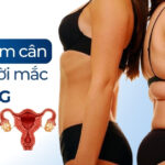 Cách giảm cân cho người mắc đa nang buồng trứng