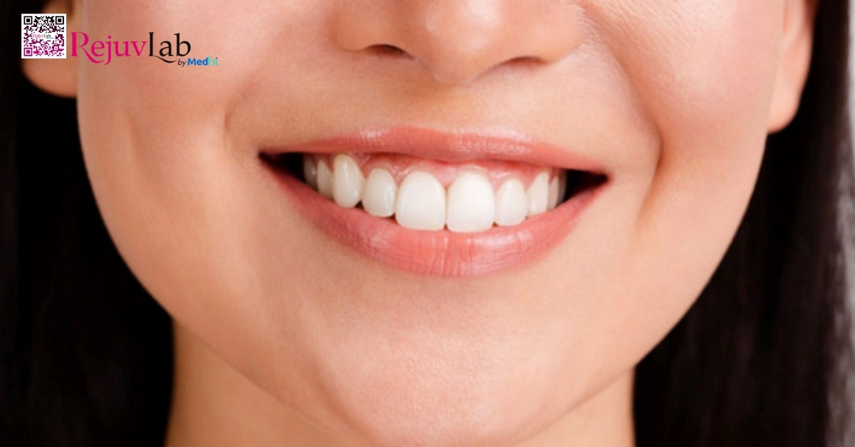 Có nên tiêm botox không? Review hiệu quả, bảng giá và rủi ro 11 Có nên tiêm botox không? Review hiệu quả, bảng giá và rủi ro 10