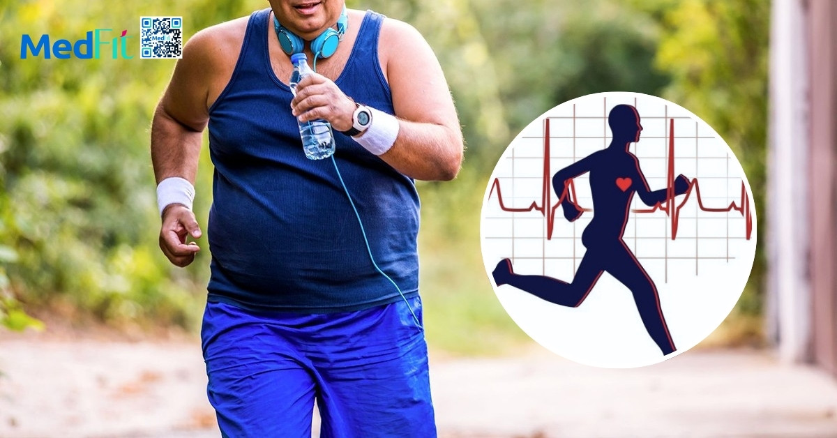 Nên đi bộ bao nhiêu bước mỗi ngày để giảm cân và đánh bay mỡ bụng? 4 Nên đi bộ bao nhiêu bước mỗi ngày để giảm cân và đánh bay mỡ bụng? 3