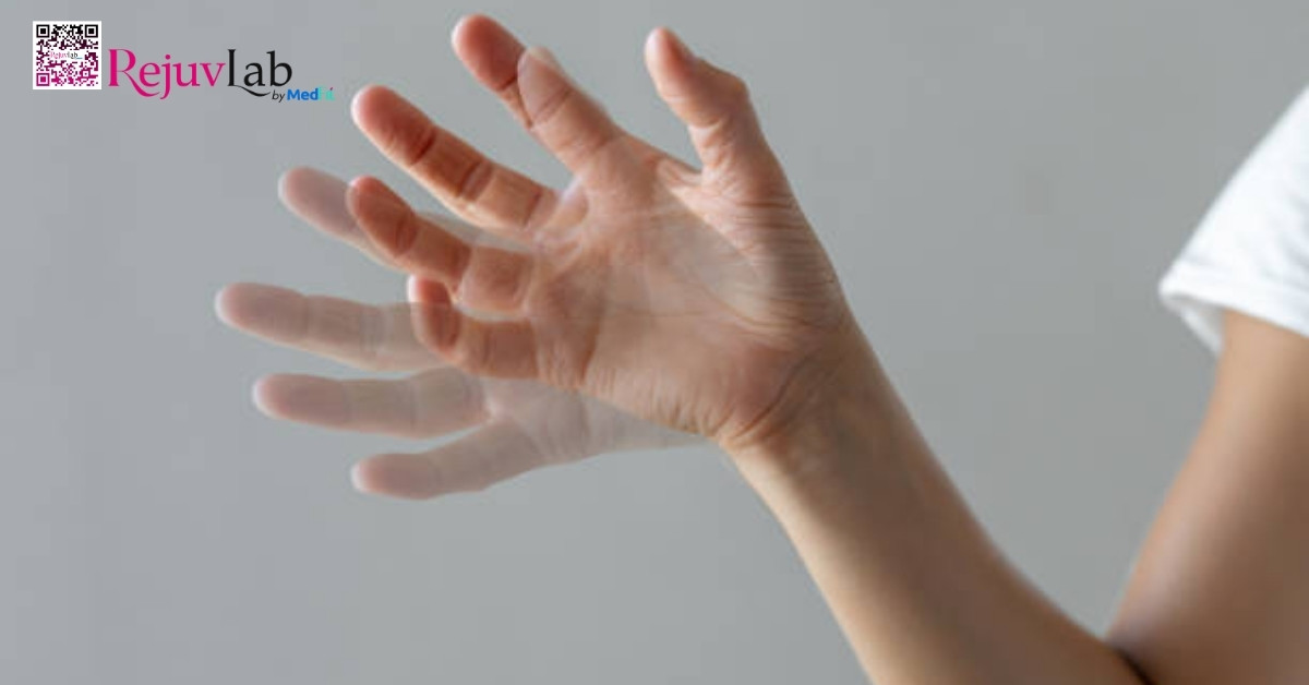 Tiêm botox bị lỗi phải làm sao? Top các cách làm tan botox nhanh và hiệu quả nhất 5 Tiêm botox bị lỗi phải làm sao? Top các cách làm tan botox nhanh và hiệu quả nhất 4