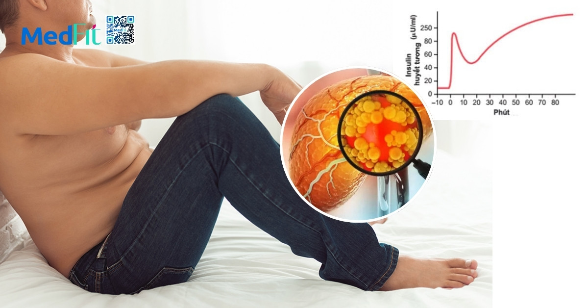 Tại sao người béo phì thiếu vitamin D? Nguyên nhân, hậu quả và cách bổ sung 10 Tại sao người béo phì thiếu vitamin D? Nguyên nhân, hậu quả và cách bổ sung 9