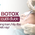Tiêm botox không cười được: Đừng hoảng loạn, hãy đọc ngay bài viết này!