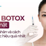 Tiêm botox bị đơ mặt: Nguyên nhân và cách khắc phục hiệu quả nhất