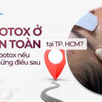 Tiêm botox ở đâu an toàn tại TP.HCM? Đừng tiêm botox nếu chưa biết những điều sau