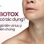 Tiêm botox bao lâu có tác dụng? Hiệu quả, giá tiền và lưu ý để tránh biến chứng
