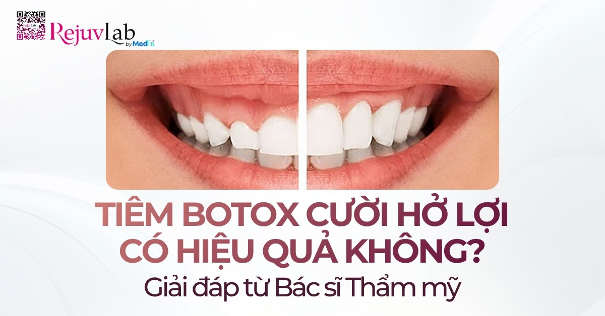 Kiến thức 36