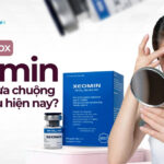 Tại sao botox Xeomin lại được ưa chuộng hàng đầu hiện nay?