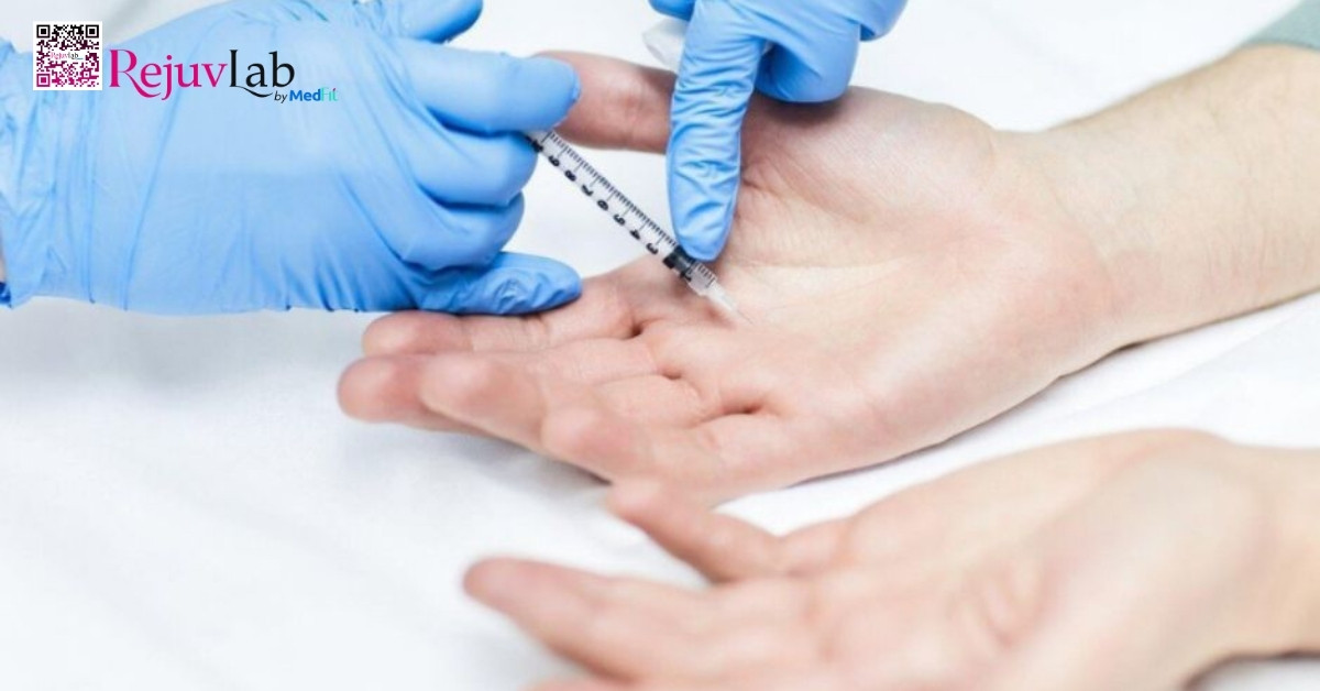 Giá tiêm botox trị mồ hôi tay là bao nhiêu? Bảng giá cập nhật 2026 2 Giá tiêm botox trị mồ hôi tay là bao nhiêu? Bảng giá cập nhật 2026 1