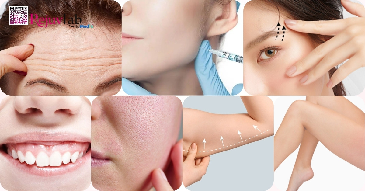 Có nên tiêm botox không? Review hiệu quả, bảng giá và rủi ro 2 Có nên tiêm botox không? Review hiệu quả, bảng giá và rủi ro 1