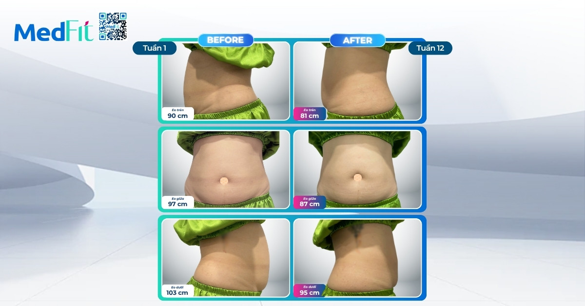 Hành trình giảm gần 8kg và 27cm vòng eo chỉ với dinh dưỡng và vận động sau 12 tuần 5 Hành trình giảm gần 8kg và 27cm vòng eo chỉ với dinh dưỡng và vận động sau 12 tuần 4