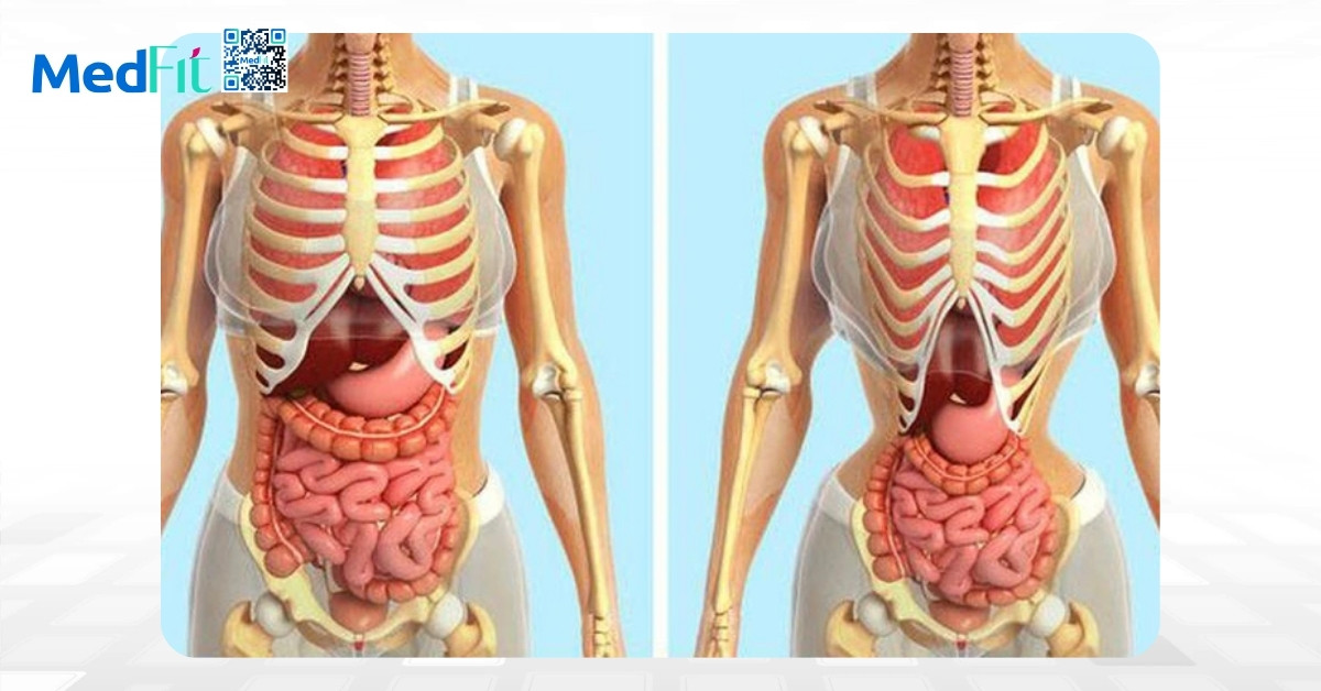 Đeo đai nịt bụng có giảm mỡ bụng không? Làm sao để giảm mỡ bụng hiệu quả? 5 Đeo đai nịt bụng có giảm mỡ bụng không? Làm sao để giảm mỡ bụng hiệu quả? 4