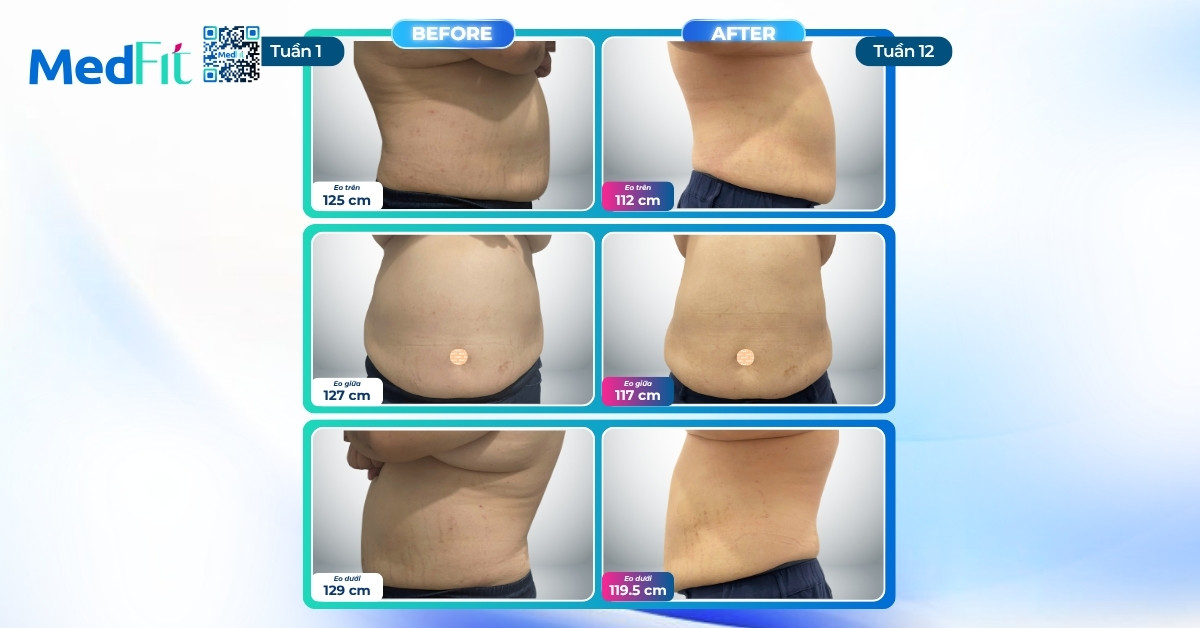 Hành trình giảm 15,2kg và đẩy lùi bệnh đái tháo đường với phác đồ chuẩn y khoa tại MedFit sau 12 tuần 5 Hành trình giảm 15,2kg và đẩy lùi bệnh đái tháo đường với phác đồ chuẩn y khoa tại MedFit sau 12 tuần 4