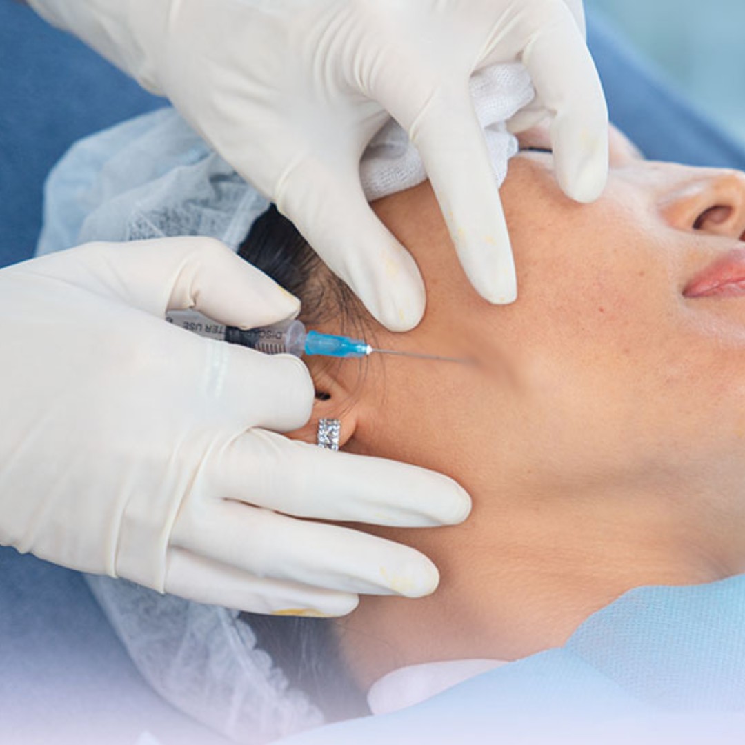 Bước 3 - Tiêm AestheFill