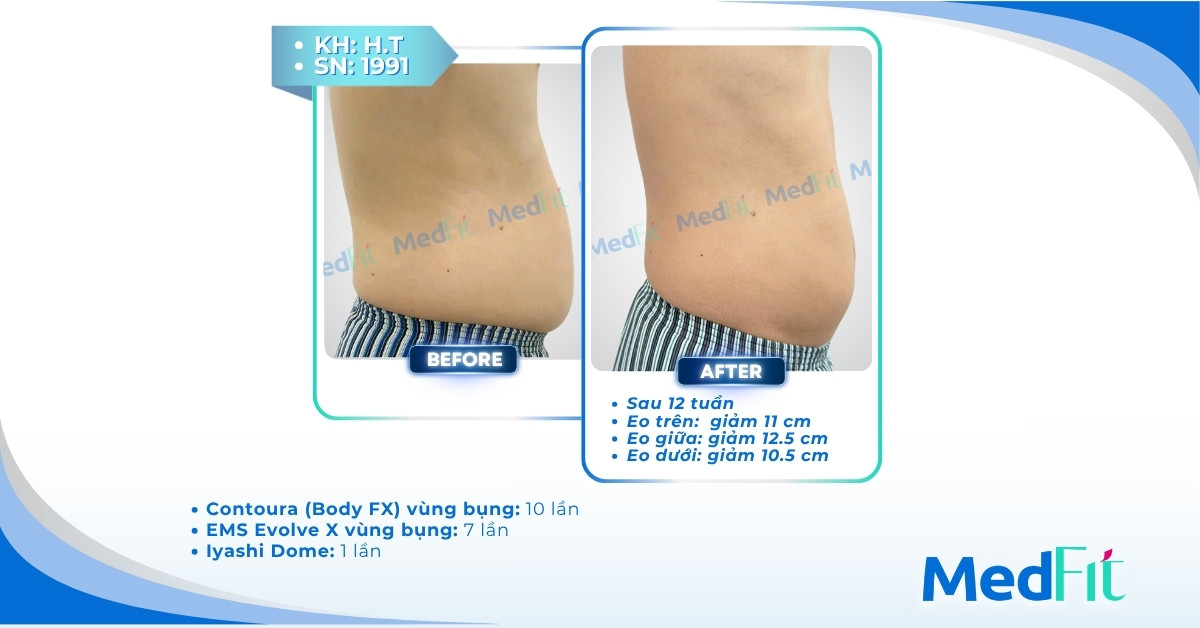 Không muốn giảm cân chỉ muốn giảm mỡ bụng thì phải làm sao? Hành trình cải thiện vóc dáng 23 Không muốn giảm cân chỉ muốn giảm mỡ bụng thì phải làm sao? Hành trình cải thiện vóc dáng 22