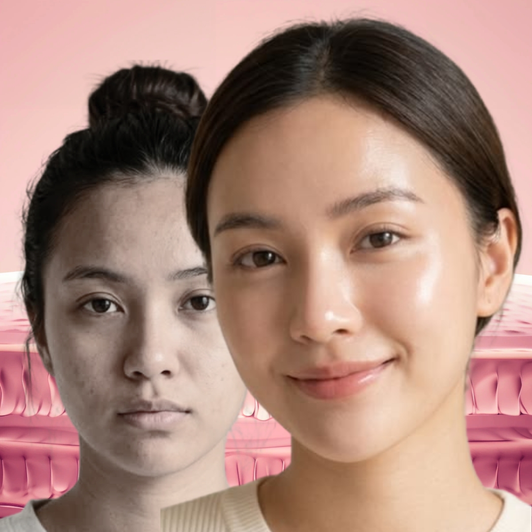 Cải thiện cấu trúc tự nhiên