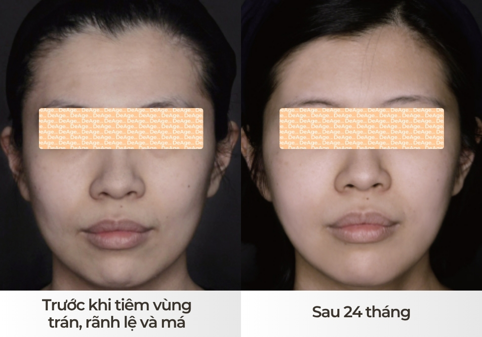 Độ an toàn dài hạn_1