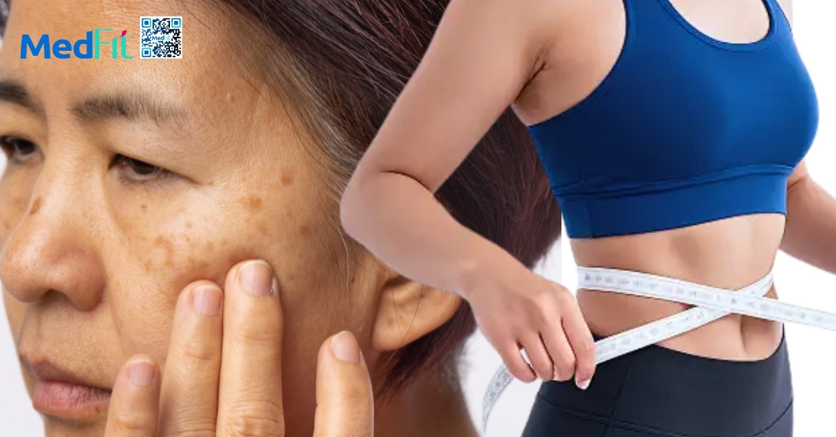 Mối liên hệ giữa béo phì và lão hoá: Hiểu đúng để sống khỏe và trẻ lâu hơn 11 Mối liên hệ giữa béo phì và lão hoá: Hiểu đúng để sống khỏe và trẻ lâu hơn 10