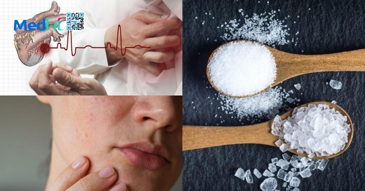 Giảm cân có giảm mỡ mặt không? Cách để mặt không bị hốc hác sau giảm cân 8 Giảm cân có giảm mỡ mặt không? Cách để mặt không bị hốc hác sau giảm cân 7